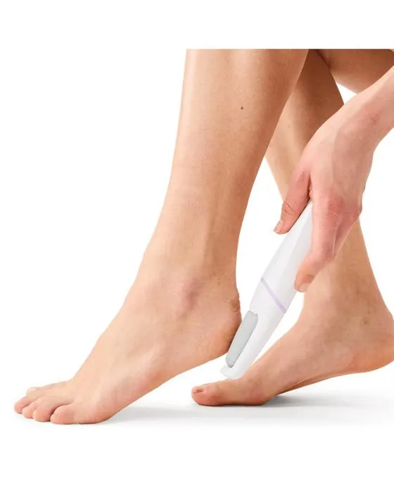 Suppression de Callus rechargeable